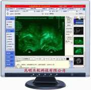 供应杰软超声影像系统工作站